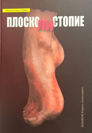 ПЛОСКОлиСТОПИЕ