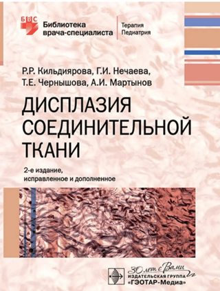 Дисплазия соединительной ткани