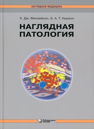 Наглядная патология