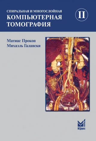 Спиральная и многослойная компьютерная томография. Том II