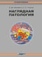 Наглядная патология