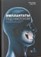 Импланты под наклоном. Протезирование с опорой на импланты при выраженной атрофии челюстей